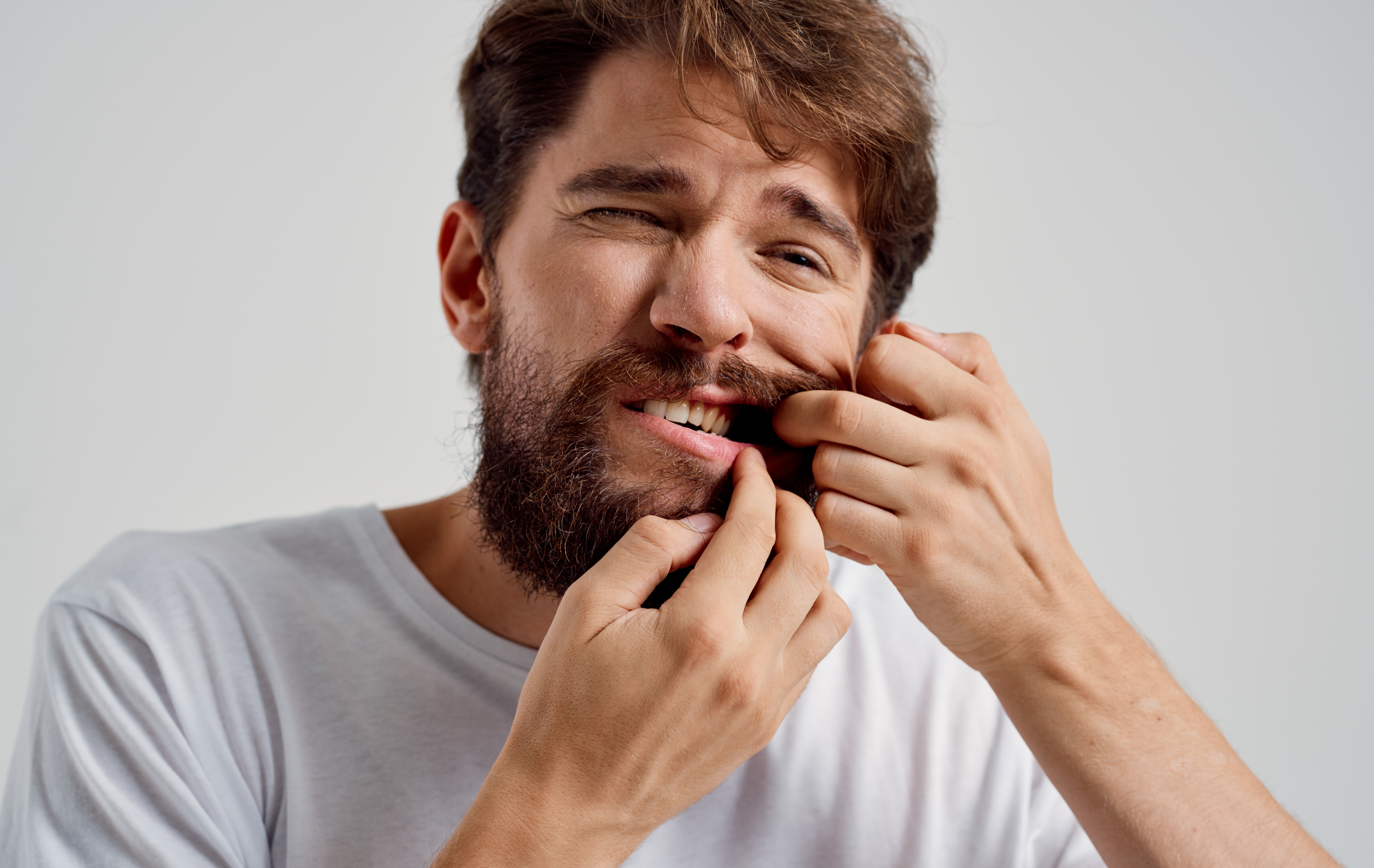 Fluorosi dentale: cos’è e come prevenirla