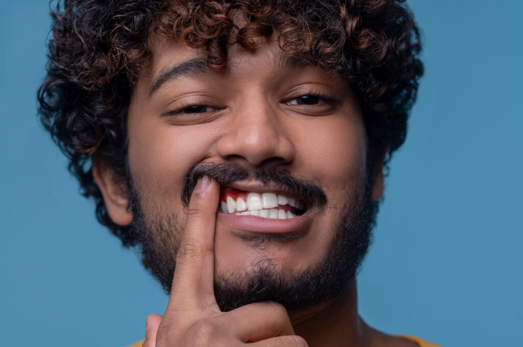 Young Indian man showing his inflamed gums